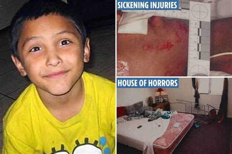 Gabriel fernandez injuries. Jun 8, 2018 · Los Angeles County Superior Court Judge George Lomeli told the couple that he hopes they wake up in the middle of the night and think of the injuries they inflicted on 8-year-old Gabriel Fernandez ... 