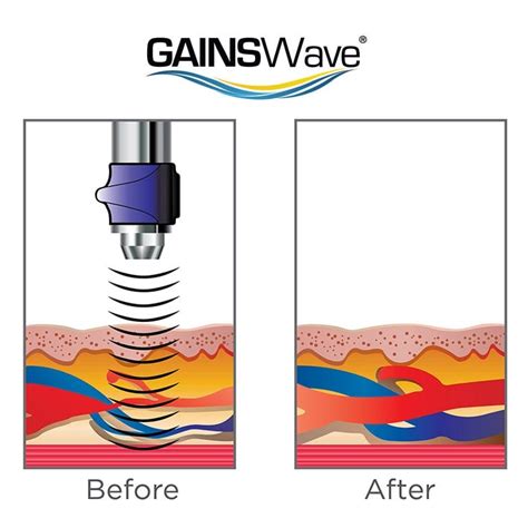 Gainswave therapy cost. .  <a href=https://ok-vatutinki.ru/2ytdax/huntsv...