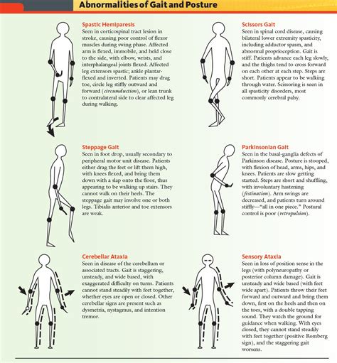Gait Abnormalities. There are eight basic pathological gaits that can be attributed to neurological conditions: hemiplegic, spastic diplegic, neuropathic, myopathic, Parkinsonian, choreiform, ataxic (cerebellar) and sensory. Observation of these gait are an important aspect of diagnosis that may provide information about several musculoskeletal ... . 