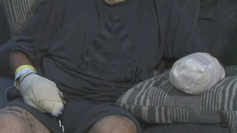 Gardener loses hand after discarded firework explodes in California neighborhood