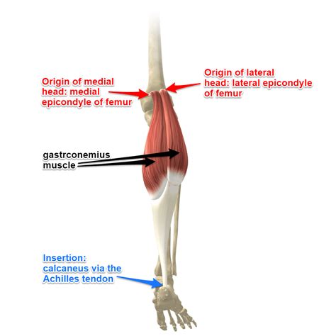 Gastrocnemius counterstrain. The muscle inserts into a triangular area along the posteromedial aspect of the proximal tibial metaphysic above the soleal line. It forms the floor of the popliteus fossa. The tendon of the popliteus passes through the popliteal hiatus, entering the knee joint and inserting into the lateral femoral condyle at the end of the popliteal sulcus. 