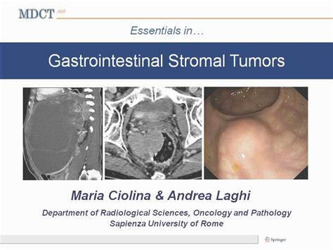 Gastrointestinal stromal tumor - Wikipedia