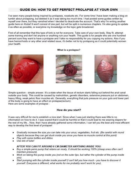 Gay fisting prolapse