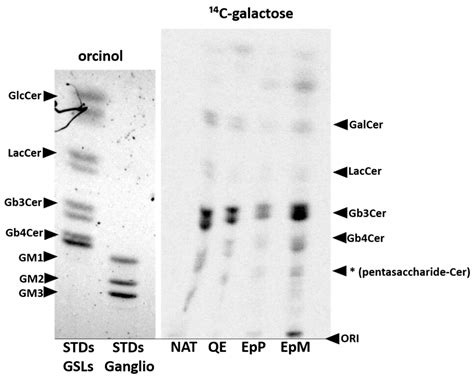 Gb3/CD77 synthase is a glycosphingolipid