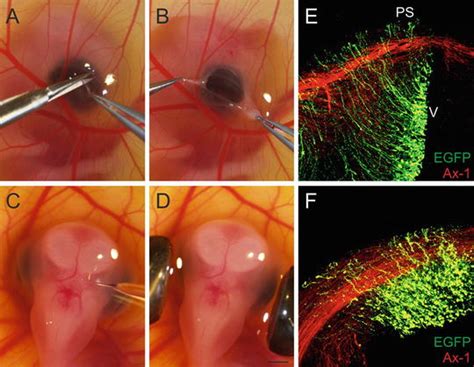 Gene Silencing in Chicken Brain Development SpringerLink