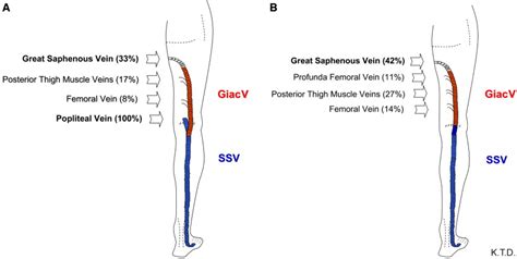 Giacomini vein Radiology Reference Article Radiopaedia.org