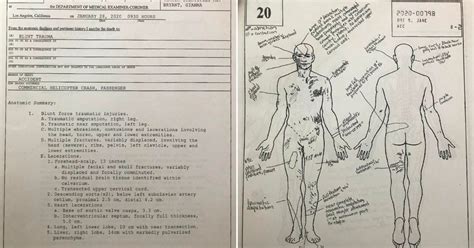 Gianna bryant's autopsy report. Things To Know About Gianna bryant's autopsy report. 