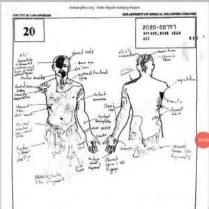 Gigi Bryant Autopsy Report Drawing. Rashed zaman April 23, 2023 PDF. A Gigi Autopsy Report PDF is a document containing the results of an autopsy performed on the body of a deceased person. An autopsy is a medical procedure that involves examining and evaluating all aspects of the body in order to determine cause, manner, and circumstances of ....