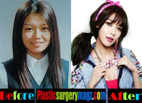 Girls Generation Plastic Surgery
