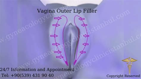 Girls spreading meaty vagina lips.  In some cases, it might even affect When people mentio...