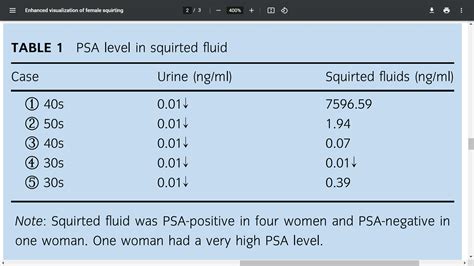 Girls squirting art.  This is the first report in which visualization of squirting wa...