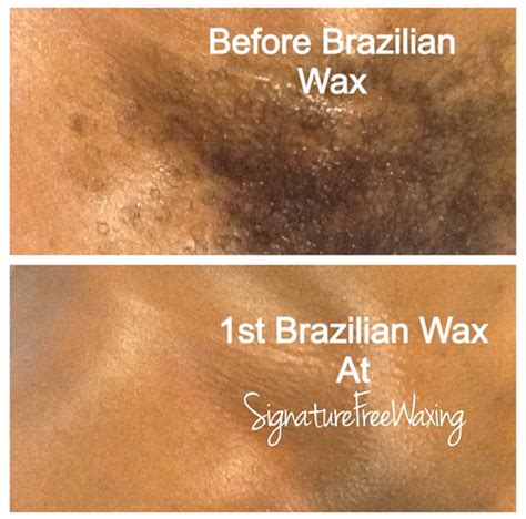 Girls with brazilin bikini wax. .  ...