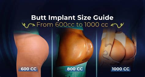 Girls with butt implants.  I specialize in buttock implant insertion.  At Columbus Institute...