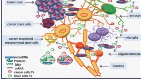 Glioblastoma Treatment - Brigham and Women