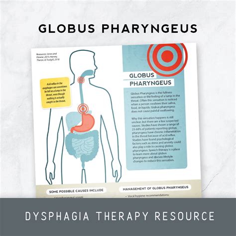 Globus pharyngeus icd 10. Globus pharyngeus is the term applied to the sensation of a lump or discomfort in the throat. The condition may be due to cricopharyngeal spasm occuring during moment of tension. globus pharyngeus is a descriptive term for the sensation of a lump in the throat and does not imply the diagnosis; globus can be caused by a wide range of throat ... 