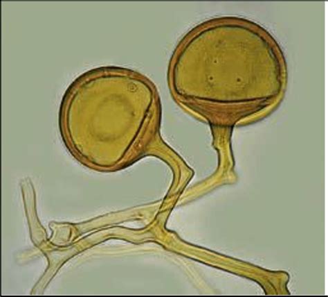 a The bi-compartimental Petri dish with transformed carrot roots colonized by the AM fungus Rhizophagus intraradices GC3 strain in the root compartment (lower side), and the extraradical mycelium and spores developed in the hyphal compartment containing sterilized soil sample 2 (upper side);Bar = 1 cm. b Sporocarp-like structure of …. 