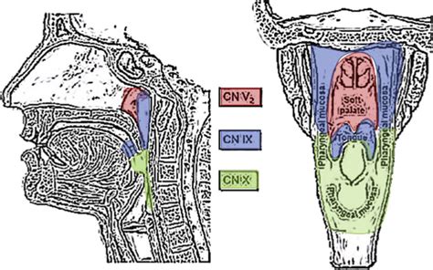 Glossopharyngeal neuropathy - The Journal of the American …