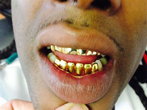 Gold teeth orlando. Things To Know About Gold teeth orlando. 