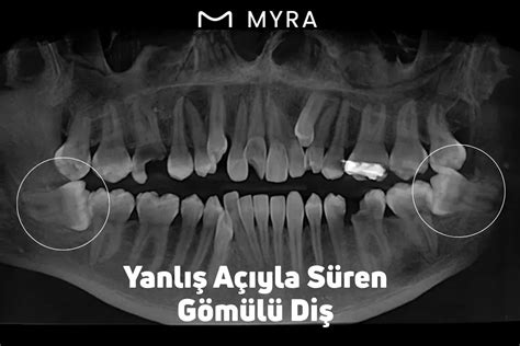 Gomulu Halı ve Koltuk Yıkama