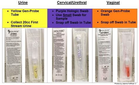 Gonorrhea/Chlamydia Testing Swabs UCSF