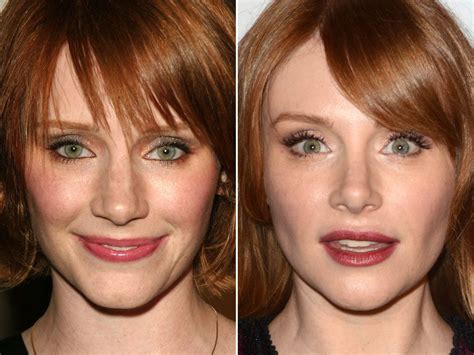 Good plastic surgery bryce dallas howard imdb, facial plastic surgery ...