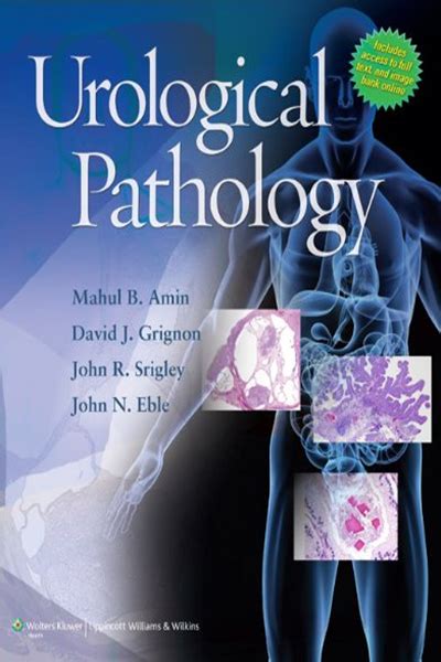 Gordos guide to gu pathology a resource for urology and pathology residents. - Testo junkie sexe drogue et biopolitique.