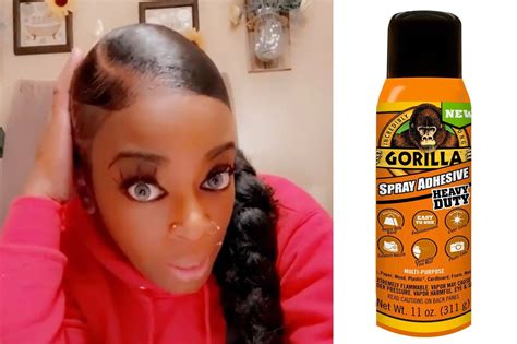Gorilla Glue hair mishap comes to an end