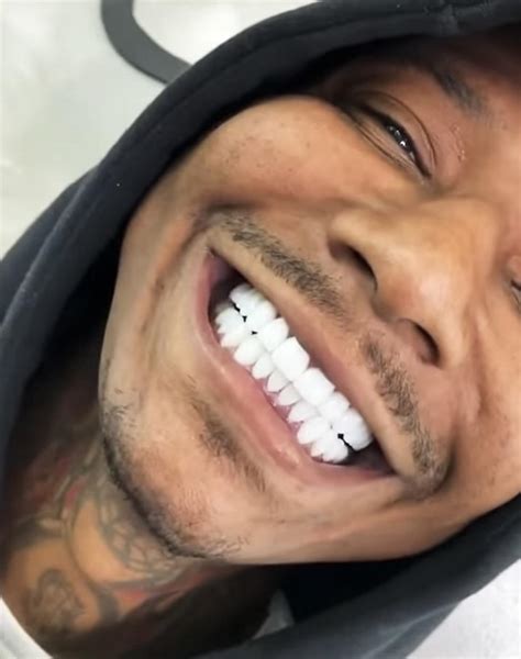 6 Rappers Who Got Their Teeth Fixed. Miranda J. Published: Mar