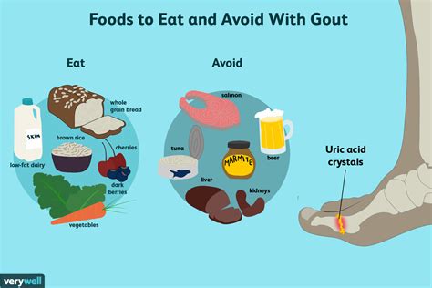 Gout Dietary Needs: What to Eat and What to