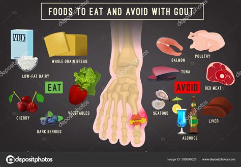 Gout and Alcohol: What is the Best Thing to Drink if You Have Gout?