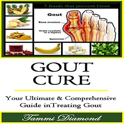 Gout cure your ultimate and comprehensive guide in treating gout. - Knocking at the gate of life healing exercises from the official manual of the people am.
