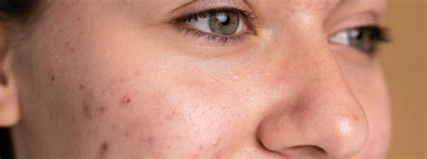 Gozenek Halı ve Koltuk Yıkama