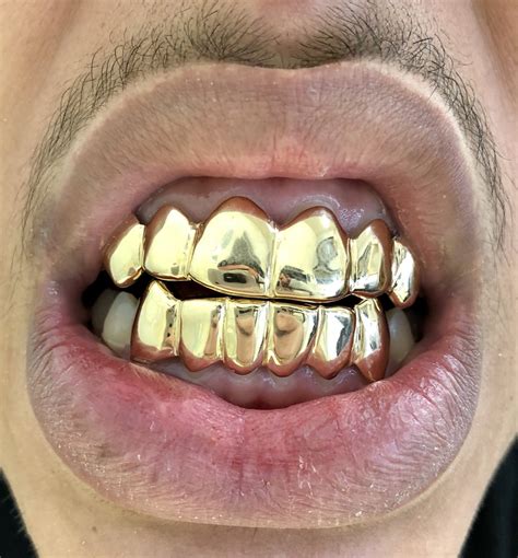 A horizontal gold bar is put across any number of teeth, and it can be set with diamonds, gems, enamel, or even letters. Most people have a six-piece, where the bar goes across the front four teeth and changes to a solid or open face grillz on the fangs, or canine teeth. Visit Our Store Today. Learn about the various custom grillz options we .... 