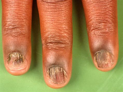 Groeven in oppervlak