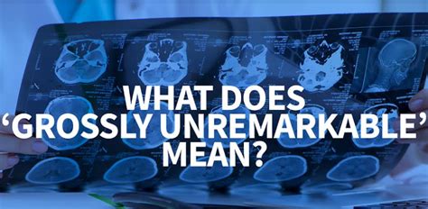 Grossly unremarkable in medical terms. As opposed to unremarkable, we may sometimes see the term grossly unremarkable used in radiology reports. Grossly unremarkable means that we do not see … See more 