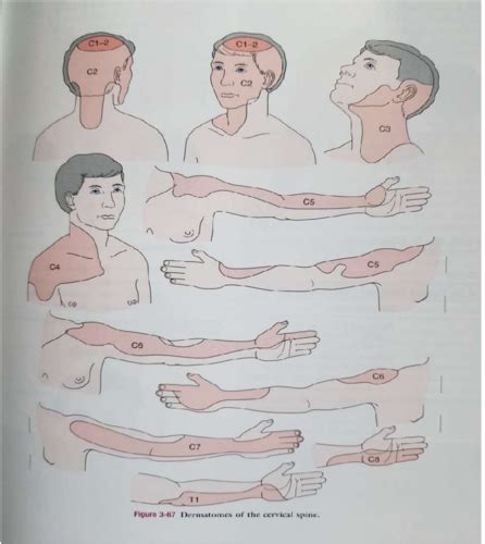 Grov neurologisk status