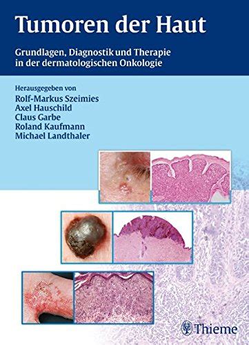 Grundlagen der topischen dermatologischen Therapie