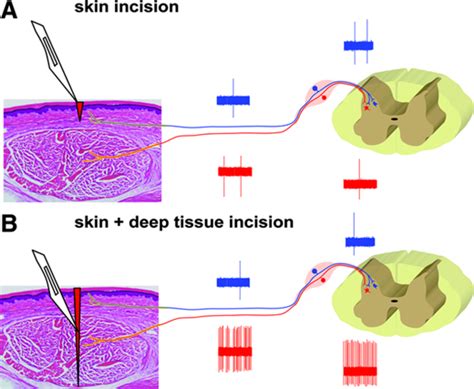 Guarding Pain and Spontaneous Activity of Nociceptors after Skin