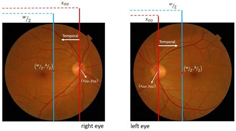 Guide Reflex Retina