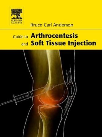Guide to arthrocentesis and soft tissue injection 1e. - Sprachkontakt in der hanse: aspekte des sprachausgleichs im ostsee- und nordseeraum.