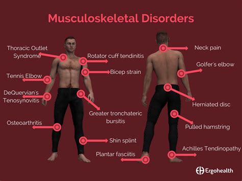 Guide to the diagnosis of musculoskeletal injuries caused by repetitive work. - Libro de texto de virología humana.