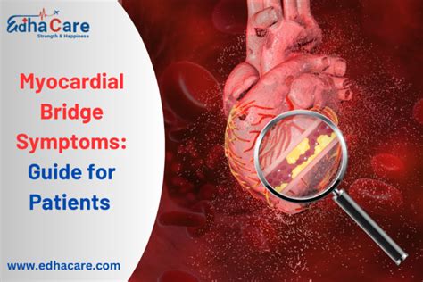 Guide to treat patients with myocardial bridging