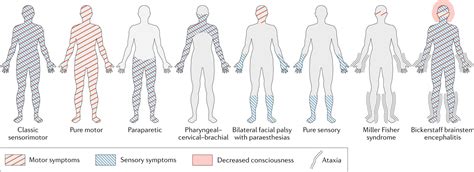 Guillain-Barre Syndrome (GBS): Diagnosis, Causes, Symptoms