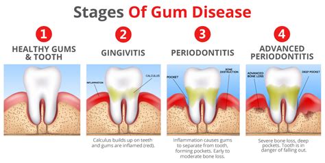 Gum Treatment in Hershey — 8 Medical Centers — Nicelocal.com