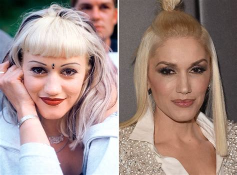 Cheryl sparked the rumors about getting lip injections with her changed appearance in her Love made me do it music video. However, the singer has denied these rumors and attributed her changed appearance to motherhood. IMAGE COURTESY : PINTEREST. 13. Gwen Stefani Lip Job. Gwen Stefani is another famous example of celebrity lip augmentation.. 