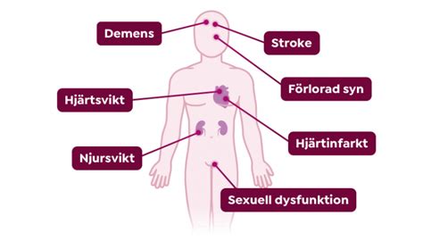 Högt undertryck symtom
