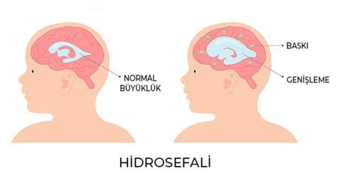 veodersti.rgarabwor.edu.pl. 