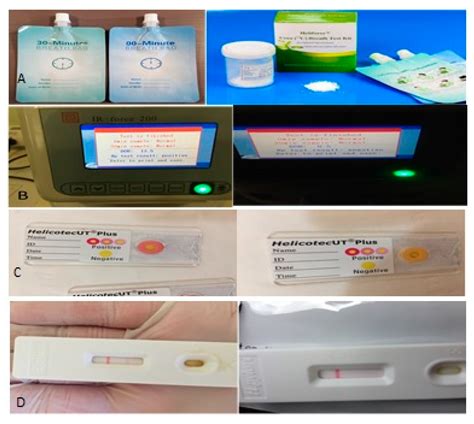 Also known as rapid urease test, a CLO test is a test that is used to determine the presence of Helicobacter pylori. The test involves placing a biopsy sample on a gel that contains buffers, phenol red, pH indicator and urea or a reaction s.... 