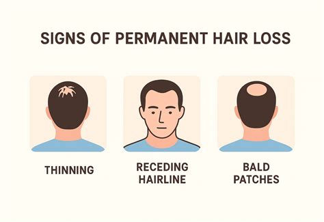 Hair loss - Symptoms and causes - Mayo Clinic - balustradellc
