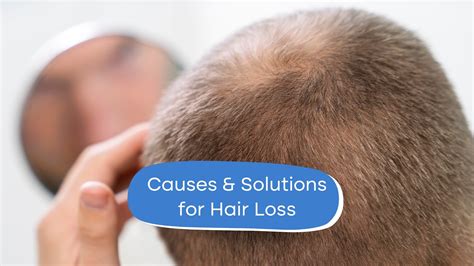 Hair Loss in Your 20s: Understanding Causes and Solutions - balustradellc